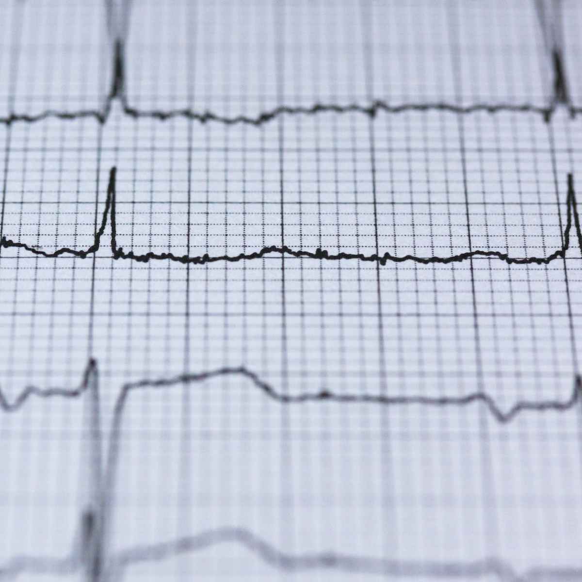 Want a healthy heart? Prioritize Quality Sleep